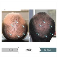 Serum kích thích mọc tóc SPECTRAL.F7 60ml - Giải pháp cho tóc mỏng và gãy rụng từ Ds Laboratories cho cả nam nữ
