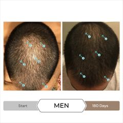 Serum Kích Thích Mọc Tóc SPECTRAL.DNC-N 60ml - Giảm Rụng Tóc, Tăng Mật Độ và Độ Dày Tóc, Công Thức Nanosome Hàng Đầu Mỹ