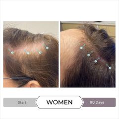 Serum Kích Thích Mọc Tóc SPECTRAL.CSF 60ml Dành Cho Phụ Nữ - Giảm Rụng Tóc và Tăng Mật Độ Tóc Khỏe Mạnh, DS Laboratories