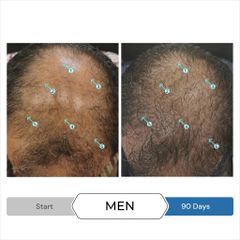 Serum Kích Thích Mọc Tóc Spectral UHP 60ml - Giảm Gãy Rụng, Thúc Đẩy Tăng Trưởng Tóc Cho Nam DS Laboratories
