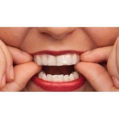MIẾNG DÁN LÀM TRẮNG RĂNG PROKUDENT