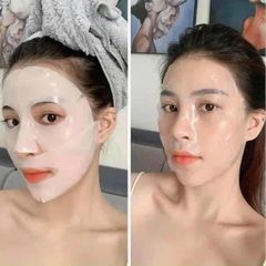 Mặt Nạ Derm All Matrix Hàn Quốc - Bộ 4 Miếng Cung Cấp Độ Ẩm và Làm Mềm Da - Sản Phẩm Chăm Sóc Da Đẹp Tự Nhiên