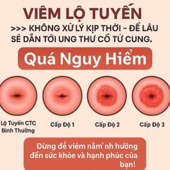 Viên Đặt Phụ Khoa Mycohydralin 500mg - Giúp Cân Bằng pH, Ngăn Ngừa Nhiễm Khuẩn và Viêm Nhiễm, Duy Trì Sức Khỏe Vùng Kín Nữ