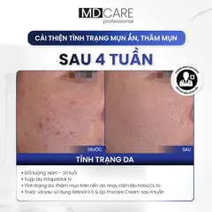 Kem Dưỡng Ẩm MD Care PRO-Retinol 0.6+Tặng sữa rửa mặt 30ml - Giảm Nếp Nhăn, Tăng Độ Đàn Hồi, Dưỡng Da Mịn Mượt, trẻ hóa Dành Cho Mọi Loại Da
