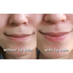 Son Dưỡng Môi Himalaya Lip Balm 10g Chiết Xuất Cà Rốt - Dưỡng Ẩm, Làm Hồng Môi An Toàn Cho Mọi Loại Da