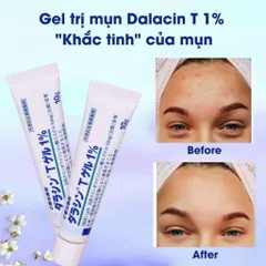 Kem mờ Sẹo Gentacin 10g - Gel Chăm Sóc Da Mụn Nhật Bản, Dưỡng Da Mịn Màng, Thẩm Thấu Nhanh, Không Gây Nhờn Rít