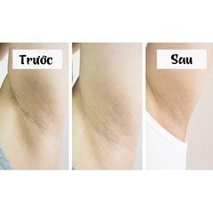 Xà Phòng Tẩy Da Chết Khử Mùi Hôi Nách Pelican - Sạch Sâu, Làm Sáng Da Dưới Cánh Tay, An Toàn Cho Da Nhạy Cảm (100g)