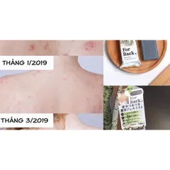 Kem Dưỡng Da Pelican Giảm Mụn Lưng 100ml - Sản Phẩm Chăm Sóc Da Chính Hãng Nhật Bản, Dưỡng Sáng Da và Ngăn Ngừa Thâm Mụn