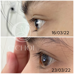 Dưỡng Mi Tế Bào Gốc C’Choi 5ml - Serum Chăm Sóc Mi Cong Dài, Chắc Khỏe Hiệu Quả Sau 5-7 Ngày