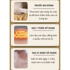 Kem Tan Hạch Bạch Huyết Nhật Bản - Giảm Bướu Cổ, Hỗ Trợ Teo Hạch, Cải Thiện Lưu Thông Mạch Máu, Sản Phẩm Chăm Sóc Sức Khỏe 30g