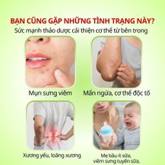 Trà Bồ Công Anh Phú Hưng AP - Hỗ Trợ Làm Đẹp Da, Chống Viêm, Thanh Nhiệt, Lợi Sữa, Thảo Dược Tự Nhiên Detox Cơ Thể