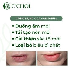Son Dưỡng Saffron C’Choi - Tinh Dầu Hoa Nghệ Tây Giúp Môi Căng Mọng, Dưỡng Ẩm, Trị Thâm, An Toàn Cho Mọi Đối Tượng