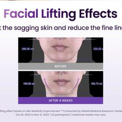 Set Kem Dưỡng Nâng Cơ Mặt BIOHEAL BOH Probioderm 3D Lifting Cream 50mL + Refill - Cấp Ẩm và Trẻ Hóa Da Từ Thiên Nhiên