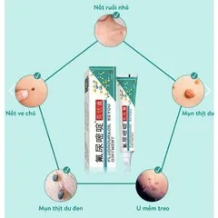Kem Rụng Mụn Thịt Dư Keyou - Chăm Sóc Da, Cải Thiện Mụn Thịt và Nốt Ruồi - Sản Phẩm Đài Loan Tự Nhiên 20g