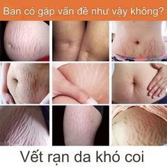 Kem Dưỡng Da 40g - Chống Rạn Da, Dưỡng Ẩm, Làm Sáng Da, Tăng Độ Săn Chắc - Sản Phẩm Chăm Sóc Da Tự Nhiên