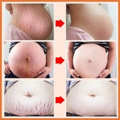 Kem Dưỡng Da 40g - Chống Rạn Da, Dưỡng Ẩm, Làm Sáng Da, Tăng Độ Săn Chắc - Sản Phẩm Chăm Sóc Da Tự Nhiên