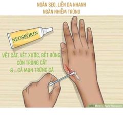 Kem mỡ Neosporin 28.3g - Hỗ trợ kháng viêm, liền sẹo, chăm sóc vết thương hiệu Mỹ cho trẻ em và người lớn