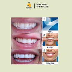 Set Dán Trắng Răng Crest 3D Whitestrips - 20 Miếng Chuyên Sâu + 10 Miếng Duy Trì, Hiệu Quả Tại Nhà, An Toàn Cho Men Răng