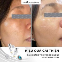Kem Nám NanoMD Cyntra Advanced Pigment Corrector 20ml - Giúp Làm Sáng Da Tối Màu, Chống Nám, Tàn Nhang, Da Đều Màu