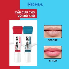 Son Dưỡng Môi Mediheal Labocare Pantenolips 10ml - Giải Pháp Chăm Sóc Môi Khô, Hồng Hào, Tươi Tắn Từ Hàn Quốc