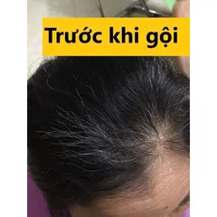 Dầu gội phủ bạc Beauty Star Hàn Quốc từ nhân sâm thảo mộc hoàn toàn tự nhiên Beauty Star Hàn Quốc