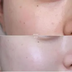 [Bill Mỹ] Kem dưỡng da hoa cúc Kiehl's Calendula Serum Infused Water Cream 100ml