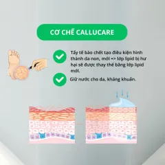 HSD 6/2026 - Kem Nứt Gót Chân Medicosh Callucare Giảm Nứt Nẻ, Chai Sạn, Thô Ráp Gót Chân 50ml