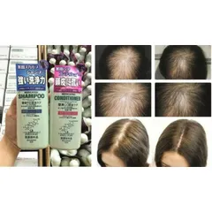 Dầu Gội Xả Ngăn Rụng Tóc Kaminomoto Của Nhật 300ml-Bộ Dầu Gội Và Dầu Xả Hỗ Trợ Mọc Tóc Kaminomoto Nhật Bản