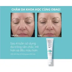 Kem Tái Tạo Da Obagi Retinol 1.0 và 360 Retinol 0.5 - Chăm Sóc Da Sáng Mịn, Giảm Nếp Nhăn, Ngăn Lão Hóa 28g