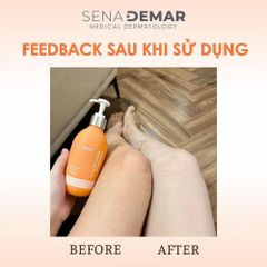 Kem Dưỡng Thể SenaDemar 10x White Body Lotion Dưỡng Trắng Da, Cấp Ẩm, Săn Chắc, Làm Mờ Thâm Nám