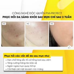 Tinh Chất Tia'm Vita B3 Source 40ml - Serum Làm Sáng & Phục Hồi Da Dầu, Mụn, Nhạy Cảm với 10% Niacinamide & 2% Alpha Arbutin