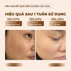 Bộ Serum & Kem Nám Mommy Care Perilla Whitening - Dưỡng Sáng, Giảm Sạm Nám, Làm Đều Màu Da 50ml & 50g/80g Hàn Quốc