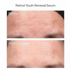 Tinh Chất Murad Retinol Youth Renewal Serum 30ml – Tái Tạo Da, Chống Oxy Hóa, Giảm Nếp Nhăn