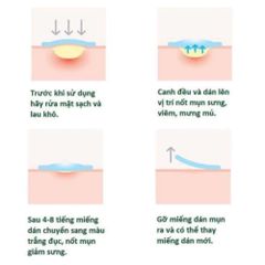 Miếng Dán Mụn Cosrx Acne Pimple Master Patch / Clear Fit Master Patch 387782