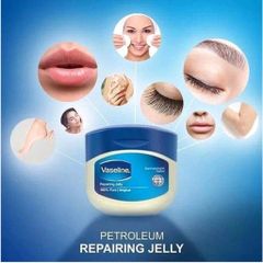 Sáp Dưỡng Ẩm Đa Năng Vaseline 50ml/100ml - Dưỡng Da, Dưỡng Môi, Giảm Nứt Nẻ, Mềm Mịn Chăm Sóc Da Hàn Quốc