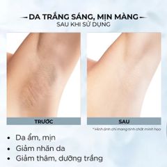 Lăn Nách Angel’s Liquid Glutathione 60ml - Giảm Thâm, Khử Mùi, Làm Sáng Da Vùng Nách Hàn Quốc, Dạng Lăn Thẩm Thấu Nhanh
