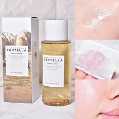 Toner Rau Má SKIN1004 Madagascar Centella 210ml - Làm Dịu & Phục Hồi Da Nhạy Cảm, Da Mụn, Cấp Ẩm, Se Khít Lỗ Chân Lông