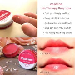 Dưỡng Môi Vaseline Lip Therapy 20g - Giữ Ẩm Mềm Mại, Chống Nứt Nẻ Hiệu Quả, Dành Cho Mọi Loại Da Môi