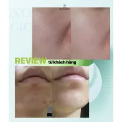 Bộ Line Dưỡng Medicube Exosome Cica – Làm Dịu, Giảm Mụn, Phục Hồi Da Nhạy Cảm, Dưỡng Ẩm, Căng Mịn 388352