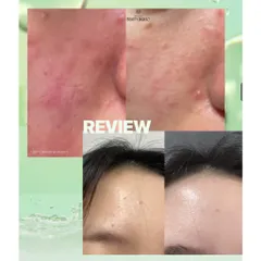 Bộ Line Dưỡng Medicube Exosome Cica – Làm Dịu, Giảm Mụn, Phục Hồi Da Nhạy Cảm, Dưỡng Ẩm, Căng Mịn 388352
