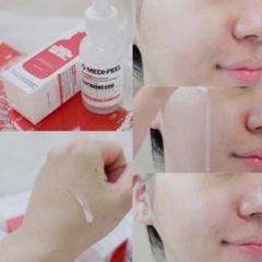 Bộ Đôi Dưỡng Trắng Da Medi-Peel 600 Glutathione - Serum & Kem Dưỡng Sáng Da, Làm Mờ Vết Thâm, Giải Pháp Cho Làn Da Khỏe Mạnh
