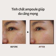 Bộ Đôi Serum Và Kem Dưỡng Chống Lão Hóa Medi-Peel Bor-Tox 30ml & 50ml – Làm Căng Bóng, Trẻ Hóa Da Chuyên Sâu