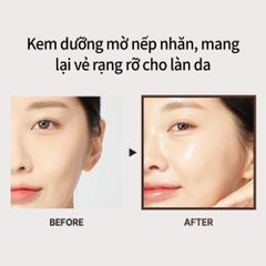 Bộ Đôi Serum Và Kem Dưỡng Chống Lão Hóa Medi-Peel Bor-Tox 30ml & 50ml – Làm Căng Bóng, Trẻ Hóa Da Chuyên Sâu