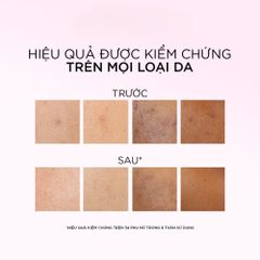 Tinh Chất Peel Sáng Da L'Oreal Glycolic-Bright 30ml - Làm Sạch Tế Bào Chết, Mờ Thâm Nám, Cải Thiện Đa Dạng Tông Màu Da