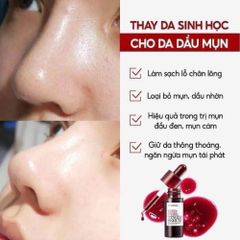 Tinh Chất Serum Red Peel Tingle So Natural 35ml - Tẩy Tế Bào Chết Hóa Học, Làm Sáng & Mịn Da, Giúp Thu Nhỏ Lỗ Chân Lông