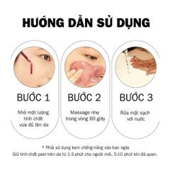 Tinh Chất Serum Red Peel Tingle So Natural 35ml - Tẩy Tế Bào Chết Hóa Học, Làm Sáng & Mịn Da, Giúp Thu Nhỏ Lỗ Chân Lông