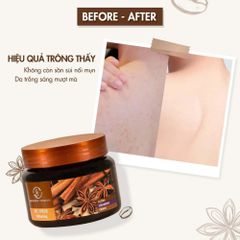Tẩy Da Chết Cơ Thể Body Quế Hồi Coffee 380g – Làm Mịn Da, Giảm Viêm Lỗ Chân Lông, Dưỡng Da Săn Chắc 388625