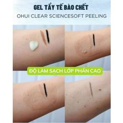 Tẩy Tế Bào Chết Da Mặt Ohui Clear Science Soft Peeling 100ml - Làm Sáng Da, Sạch Sâu, Mềm Mịn Tự Nhiên, Chống Oxy Hóa, Ngừa Mụn