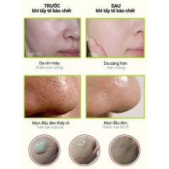 Tẩy Tế Bào Chết Da Mặt Ohui Clear Science Soft Peeling 100ml - Làm Sáng Da, Sạch Sâu, Mềm Mịn Tự Nhiên, Chống Oxy Hóa, Ngừa Mụn