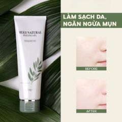 Gel Tẩy Tế Bào Chết Dr.Pepti Herb Natural 130ml - Tẩy Tế Bào Chết Dịu Nhẹ, Làm Sạch Sâu, Tái Tạo Da Mịn Màng, Hàn Quốc